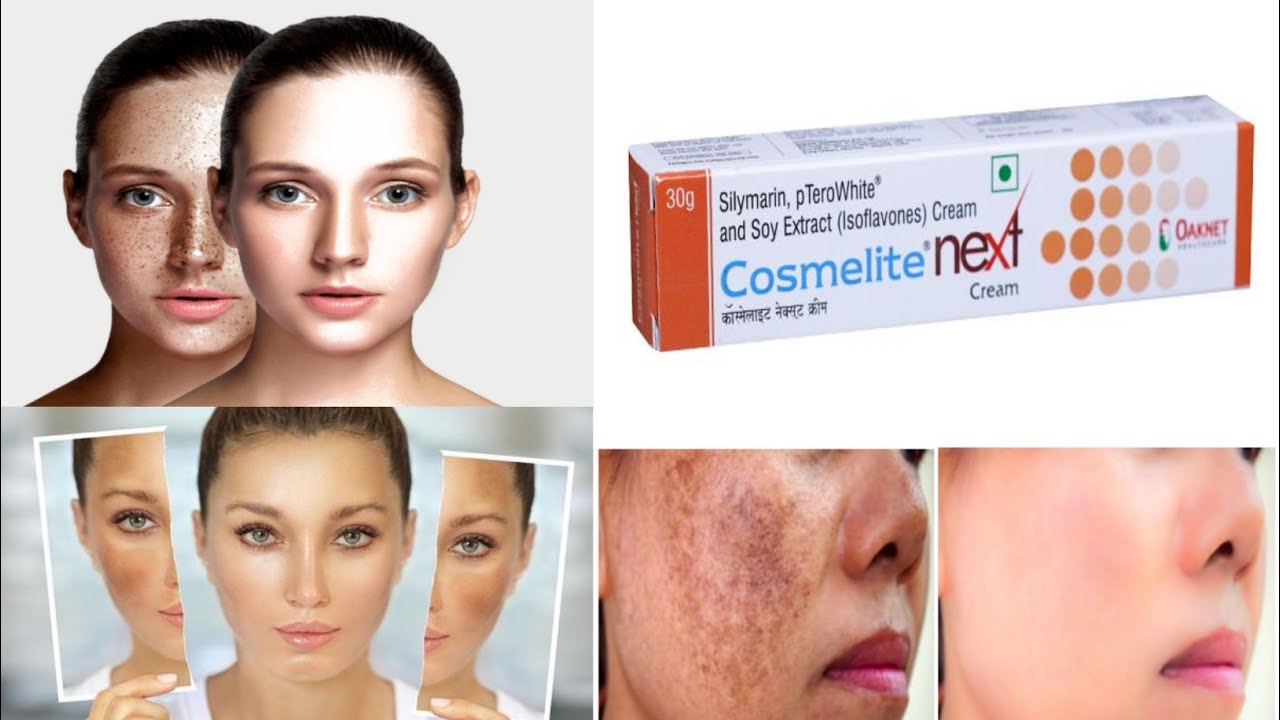 Преимущества крема Cosmelite Next на хинди | Для чего используется крем Cosmelite Next?