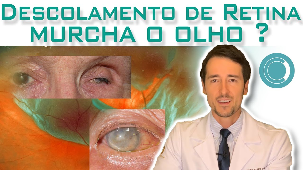 O descolamento de retina pode murchar o olho ? ?