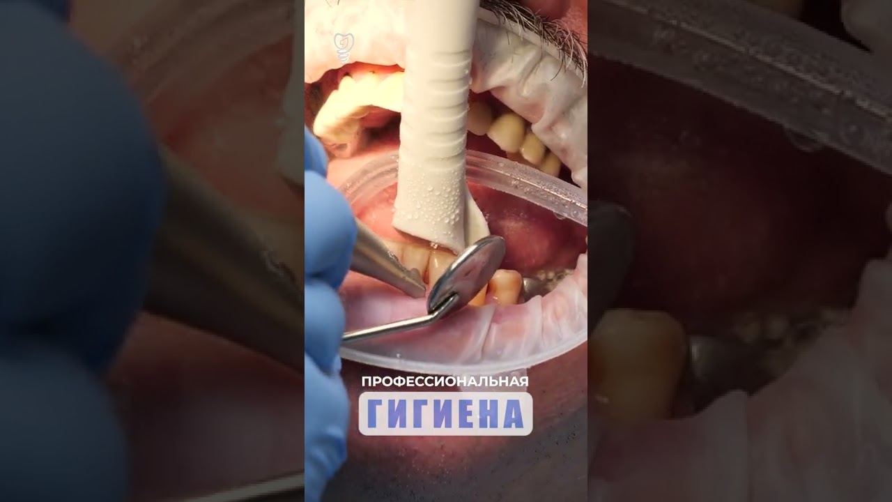 Профессиональная гигиена. Professional hygiene.