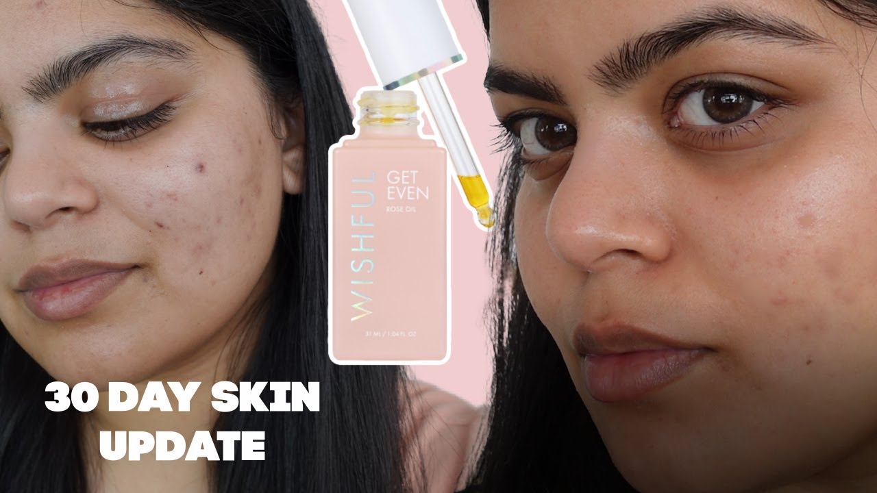 WISHFUL GET EVEN ROSE OIL 30 DAY SKIN UPDATE | ADITIMAKEUP