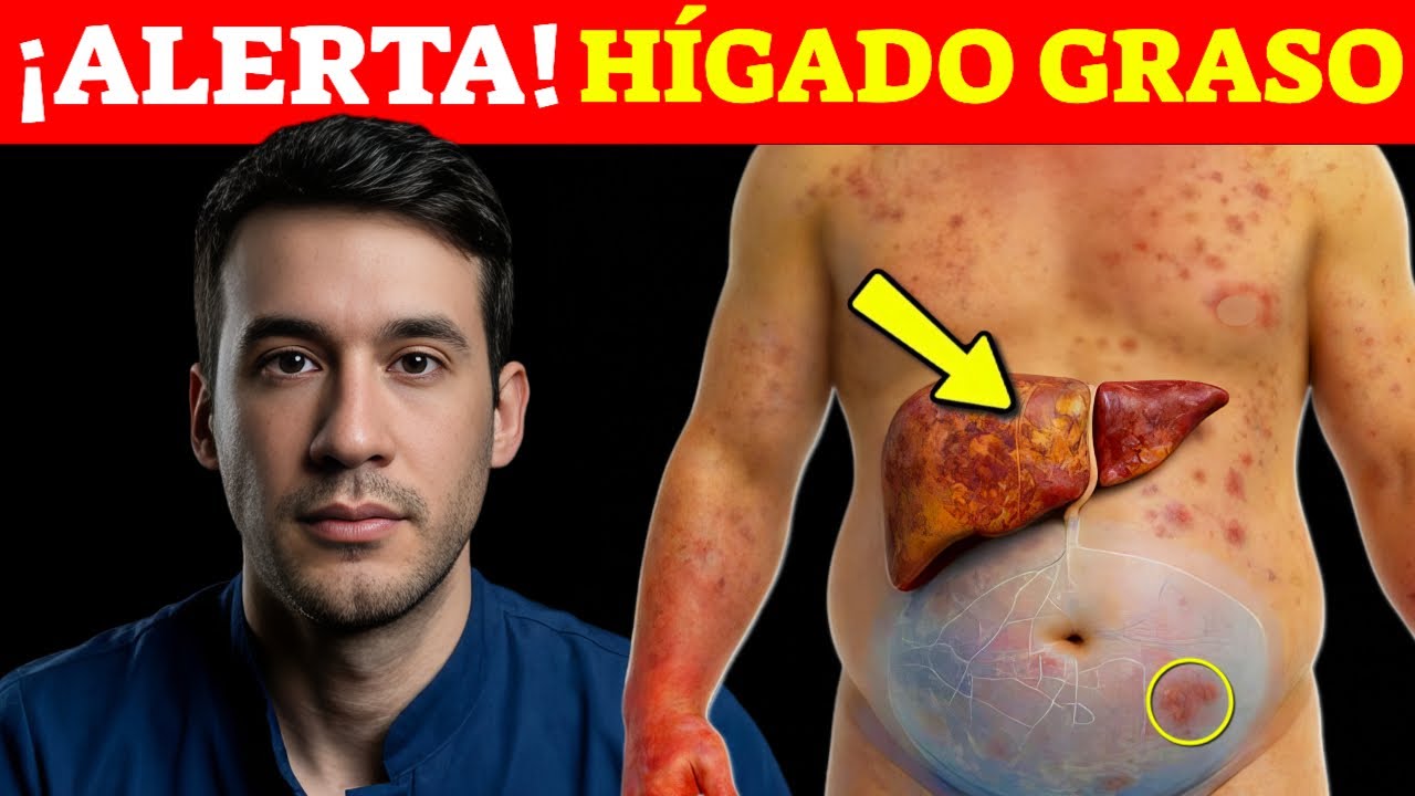 ¡Una AMENAZA SILENCIOSA! SEÑALES que INDICAN HÍGADO GRASO| PRIMEROS SÍNTOMAS