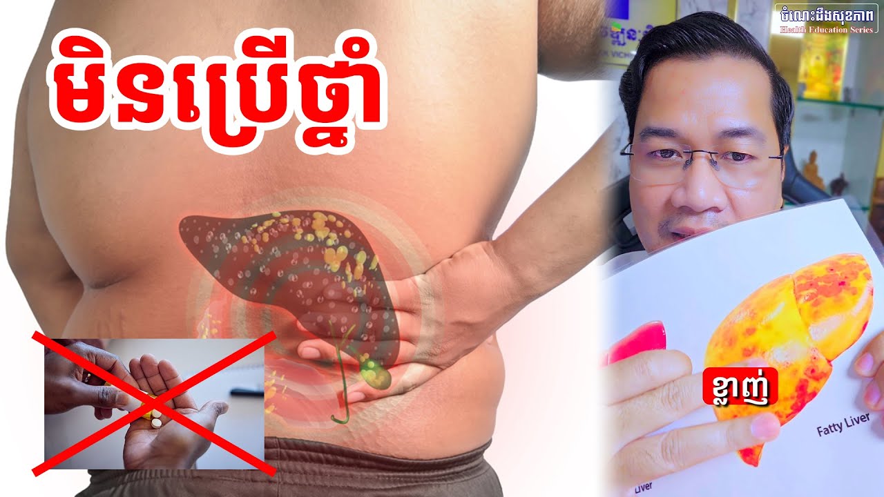 វិធីព្យាបាលខ្លាញ់រុំថ្លើមដោយមិនប្រើថ្នាំ