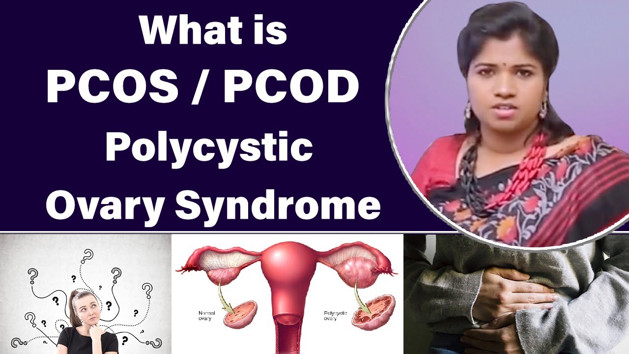 What is PCOS / PCOD | Polycystic Ovarian Syndrome | Symptoms, Causes, & Treatment | Dr.B.Yoga Vidhya