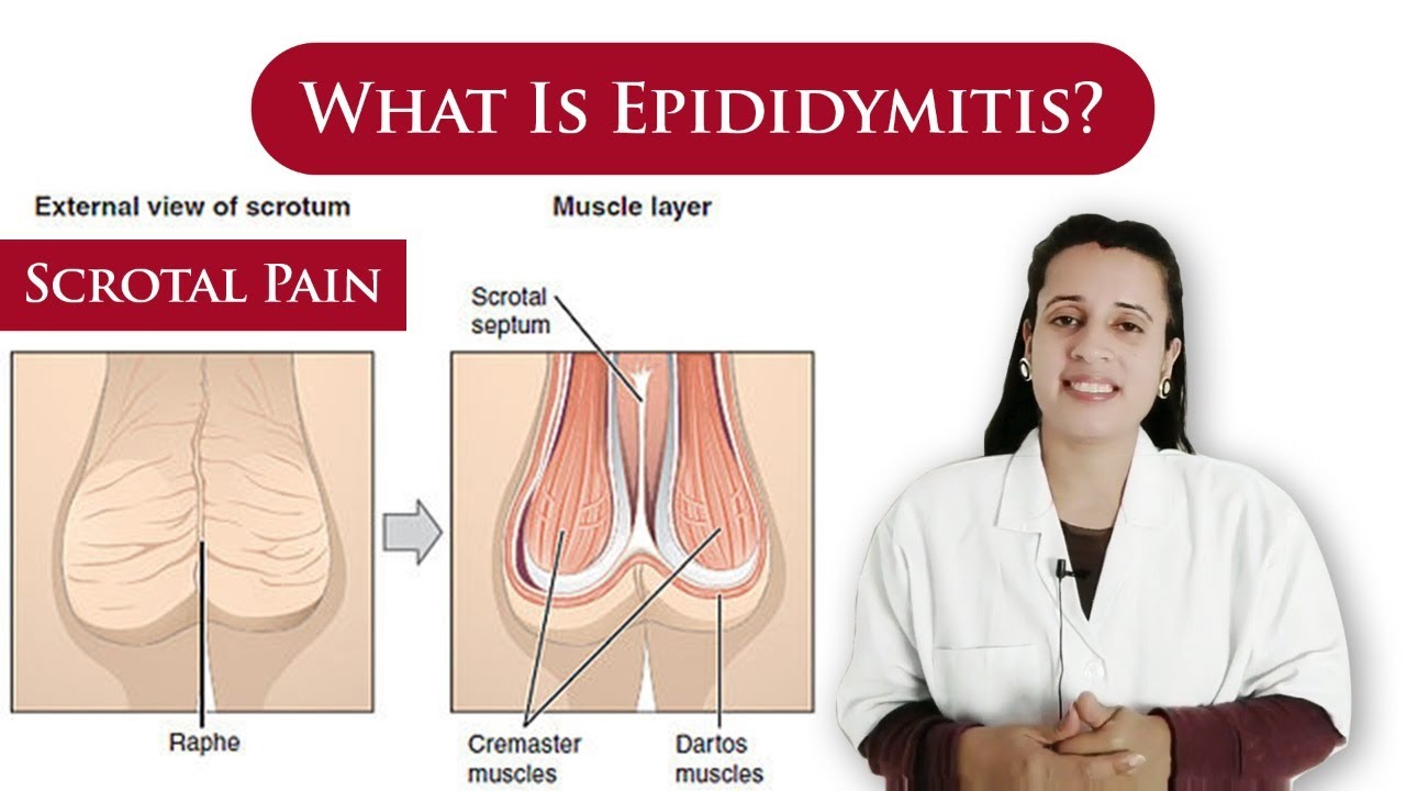 What is Epididymitis | causes, symptoms, treatment | scrotal pain | By Dr N Joshi