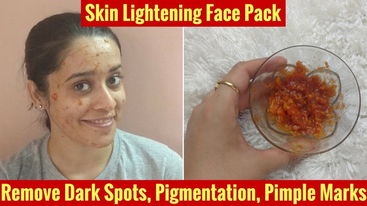 Remove DARK SPOTS, PIMPLE MARKS, PIGMENTATION | SKIN LIGHTENING | Just another girl