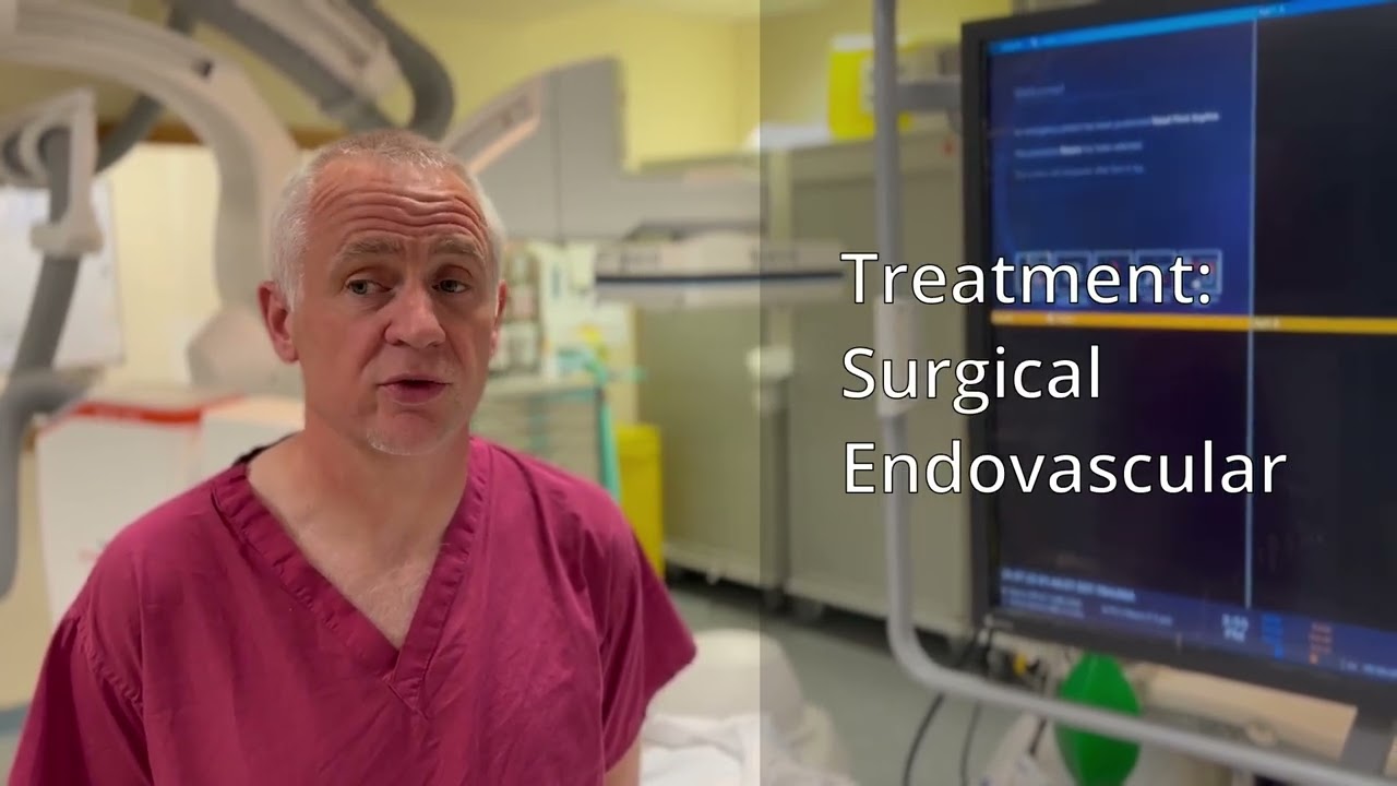 Cerebral aneurysm patient information video