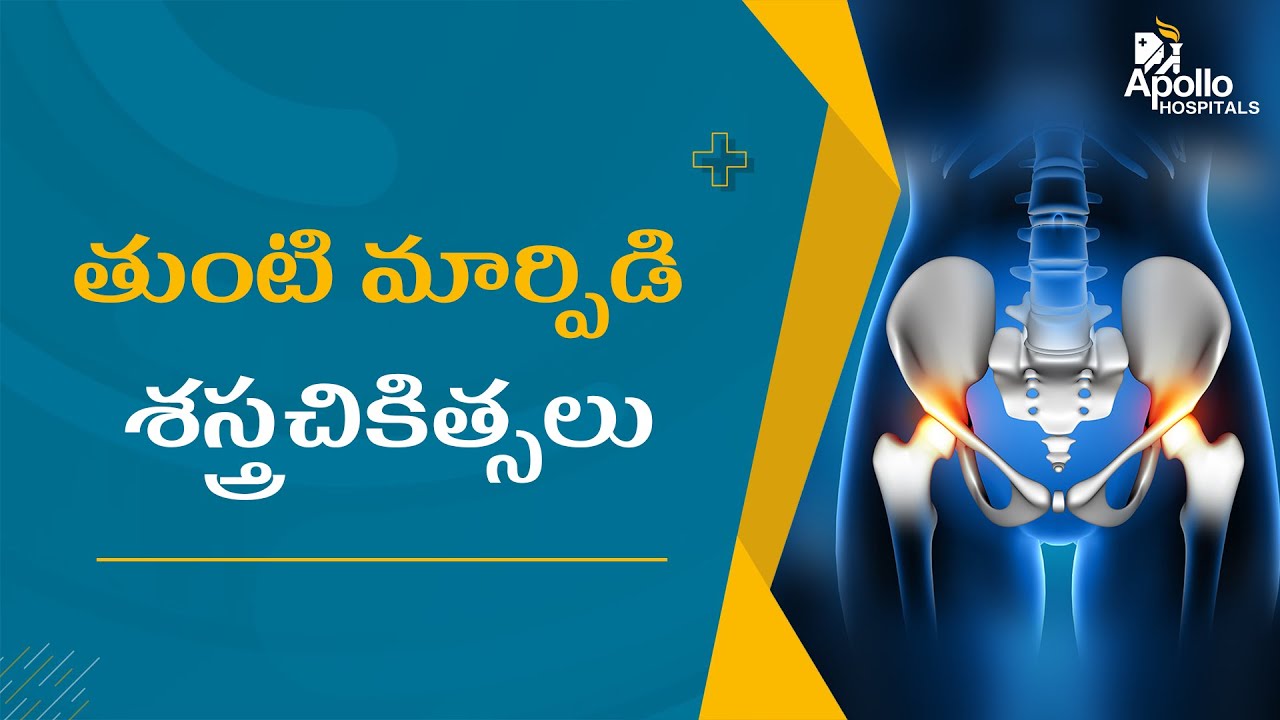 తుంటి మార్పిడి శస్త్రచికిత్స | Hip Replacement & Reconstruction Surgery | Dr Balavardhan Reddy | TV5