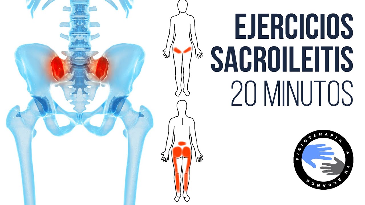 Rutina de EJERCICIOS para la SACROILEITIS o dolor de la ARTICULACIÓN SACROILIACA