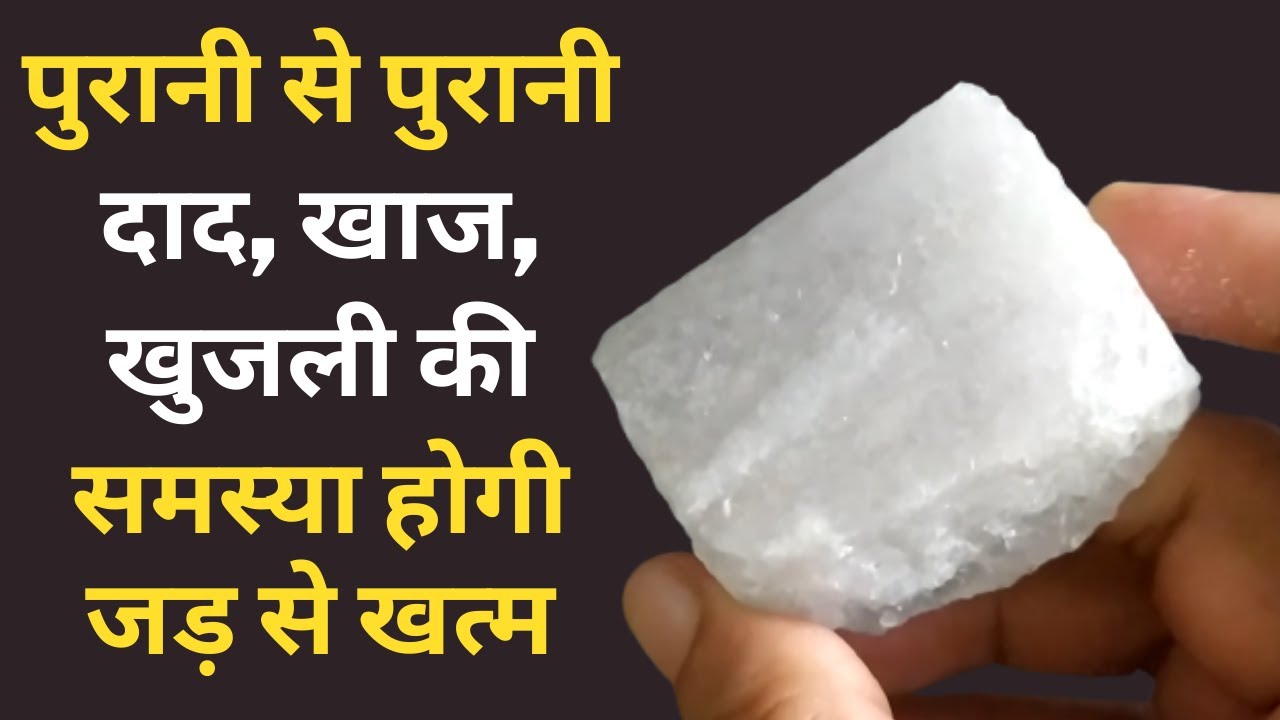 दाद, खाज, खुजली को जड़ से खत्म करने का 100% घरेलू उपाय | Natural way to get rid of itching - Khujli