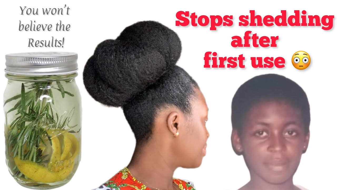 Try this for faster and thicker hair growth🔥Visible results after first use