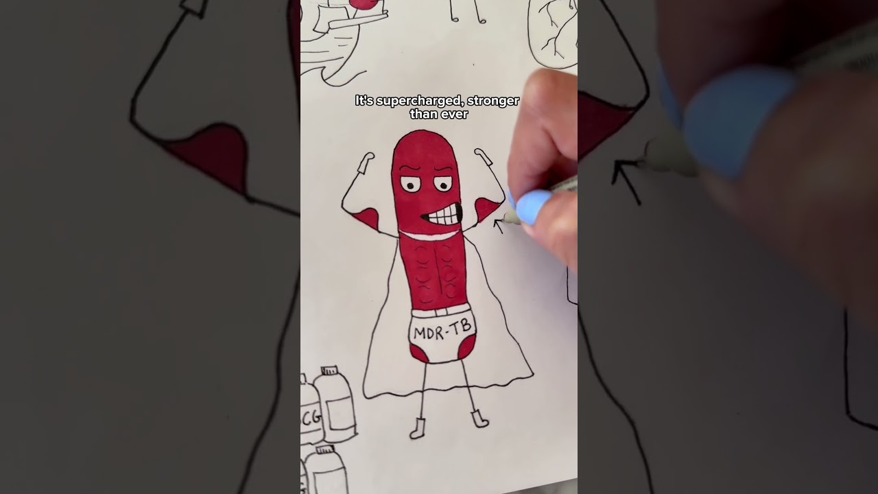 So what's Tuberculosis, anyway? Let's sketch it out ✏️
