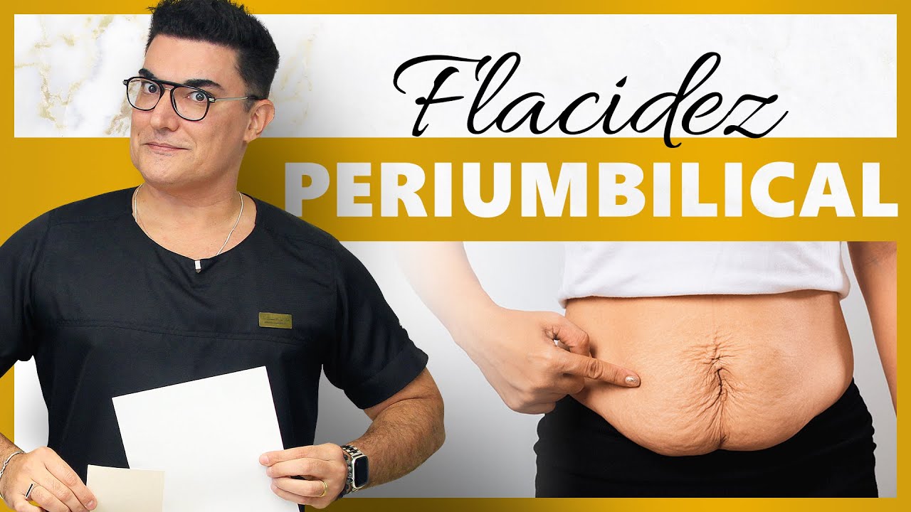 Flacidez Periumbilical