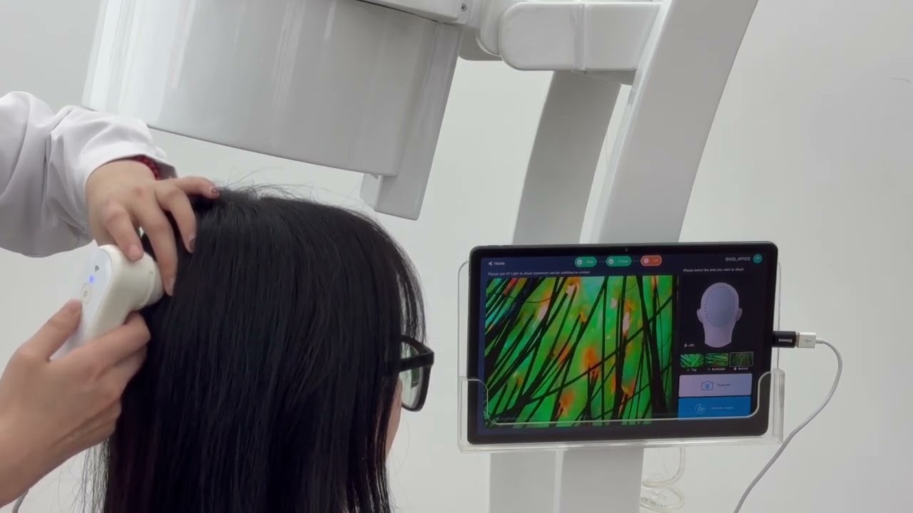 Laser na porost włosów 