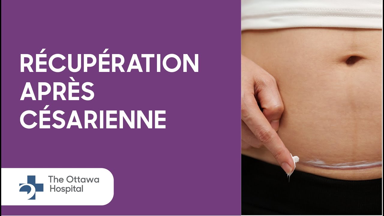 Comment se rétablir d'un accouchement par césarienne