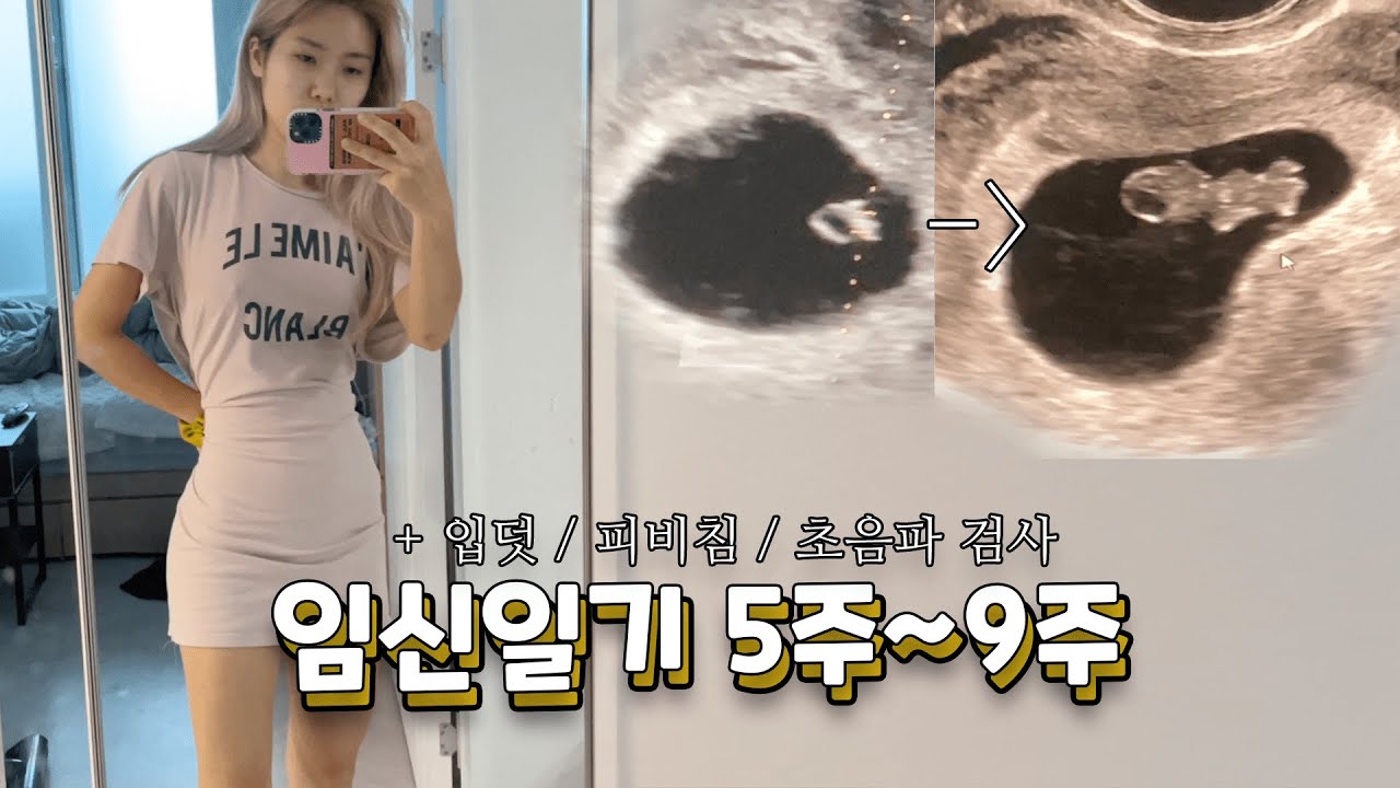 이제야 가져온 임신일기 5주~9주 vlog (입덧, 피비침, 초음파, 디스크 조각모음 ) /꽁지 KKONGJI