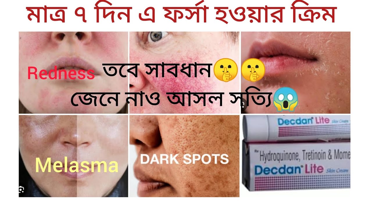 Decdan lite skin cream ব্যবহার করছো তাহলে জেনে নাও আসল সত্যি। সত্যি কি ফর্সা হওয়ার ক্রিম এটা ??🤫🤫🤫🤫