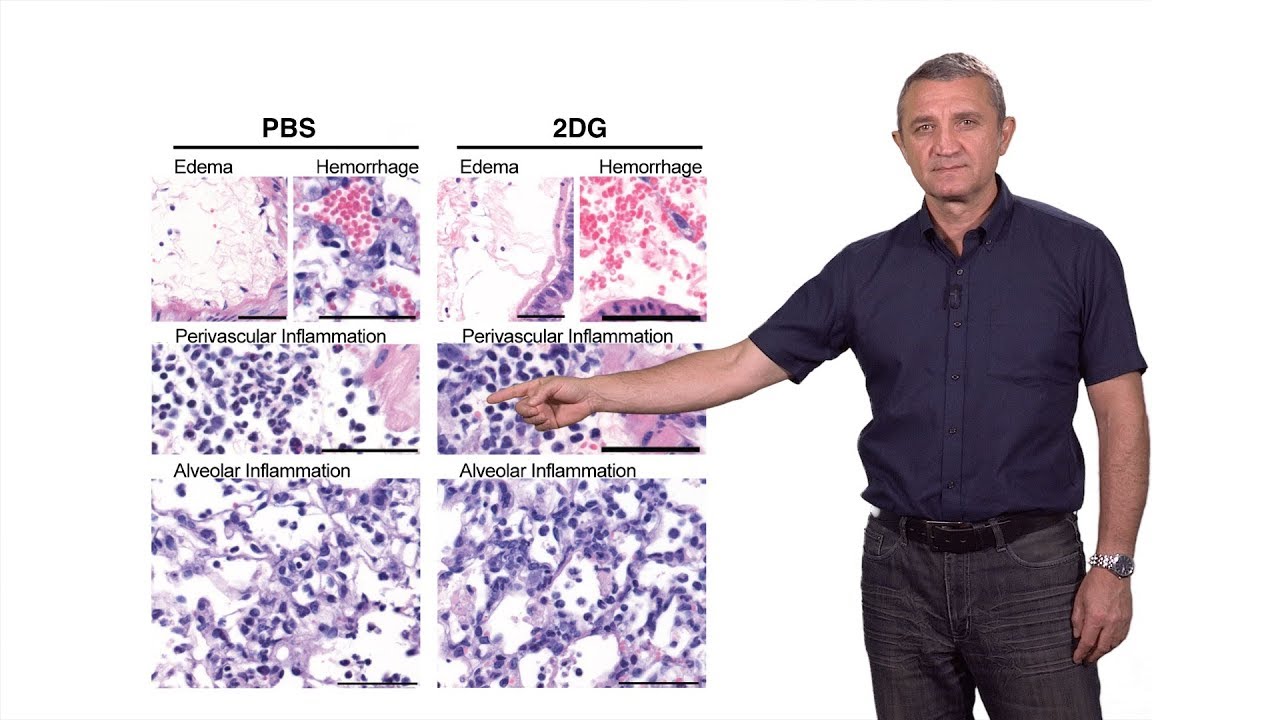 Руслан Меджитов (Йельский университет / HHMI) 2: Воспаление и толерантность к болезни: как пережи...
