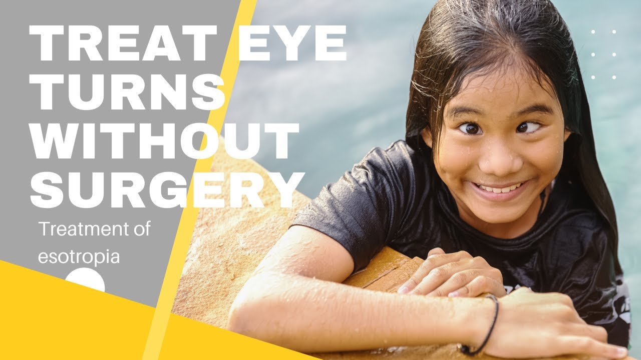 Treatment for eye turns without surgery | Vision Therapy for Esotropia