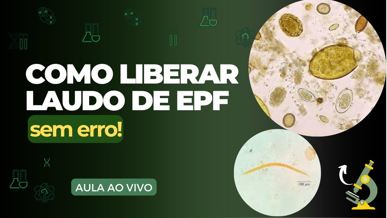 Como liberar laudo de Exame de EPF - Parasitológico de Fezes?