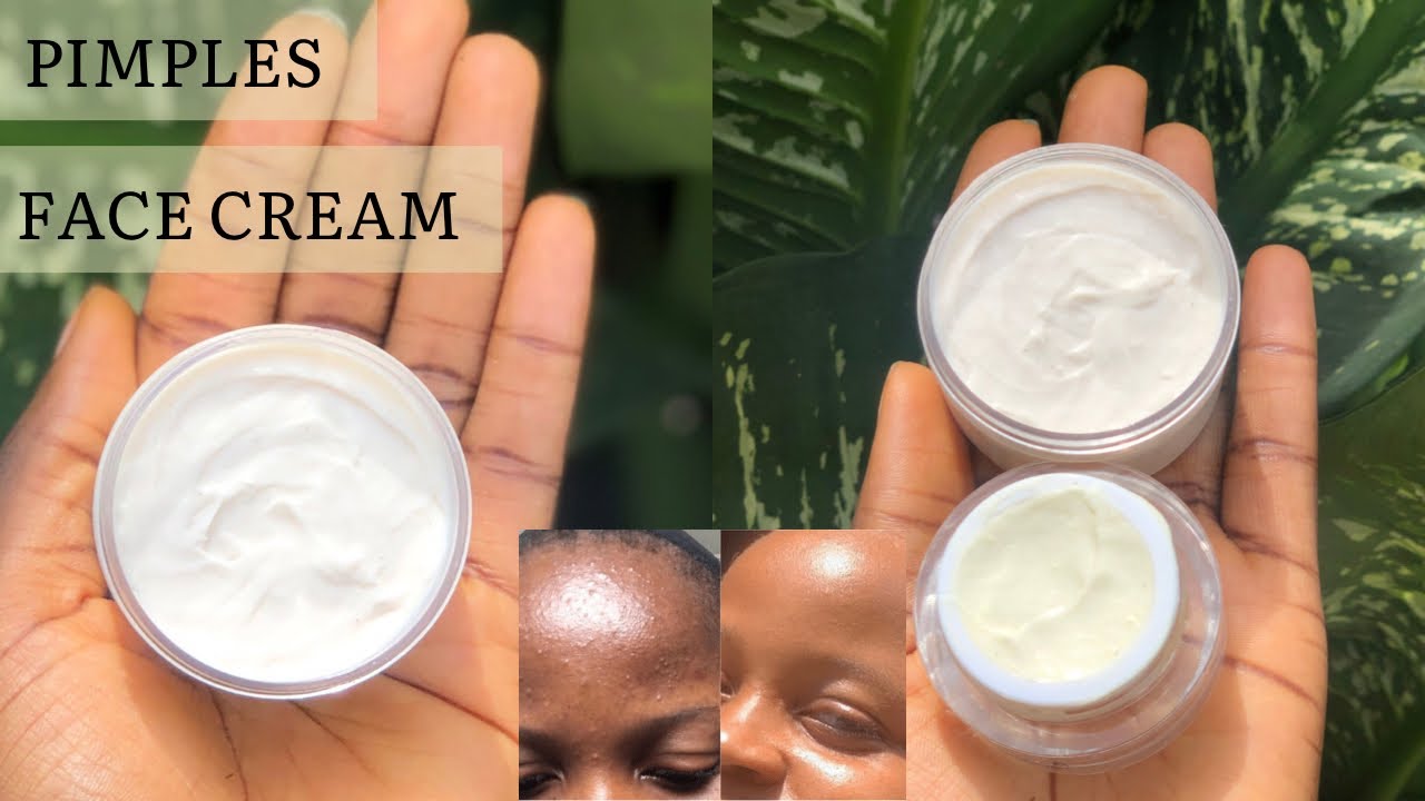 How to make face cream for pimples/acne | DIY pimples face cream | how to use neem & sulfur for acne