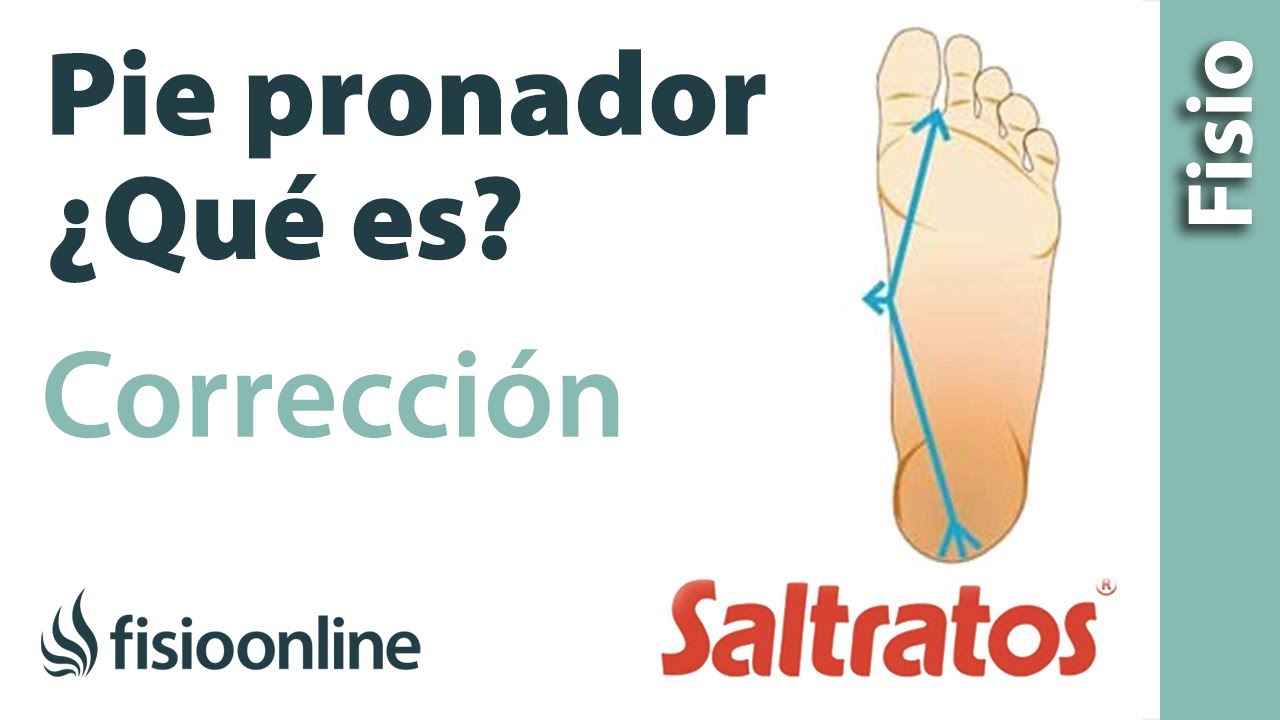 Pie pronador - Qu&eacute; es, causas y correcci&oacute;n