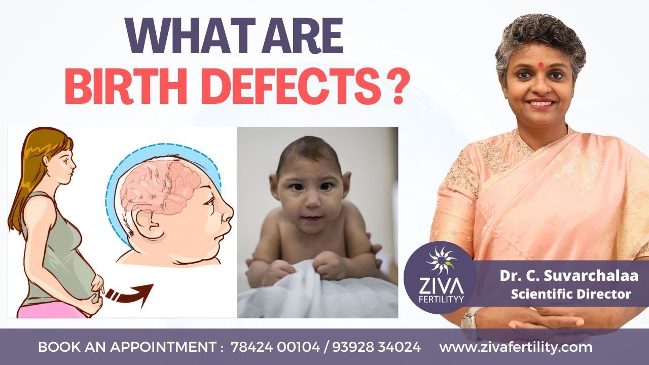 Most Common Birth Defects || Congenital Anomalies || Dr C Suvarchalaa || ZIVA Fertilityy