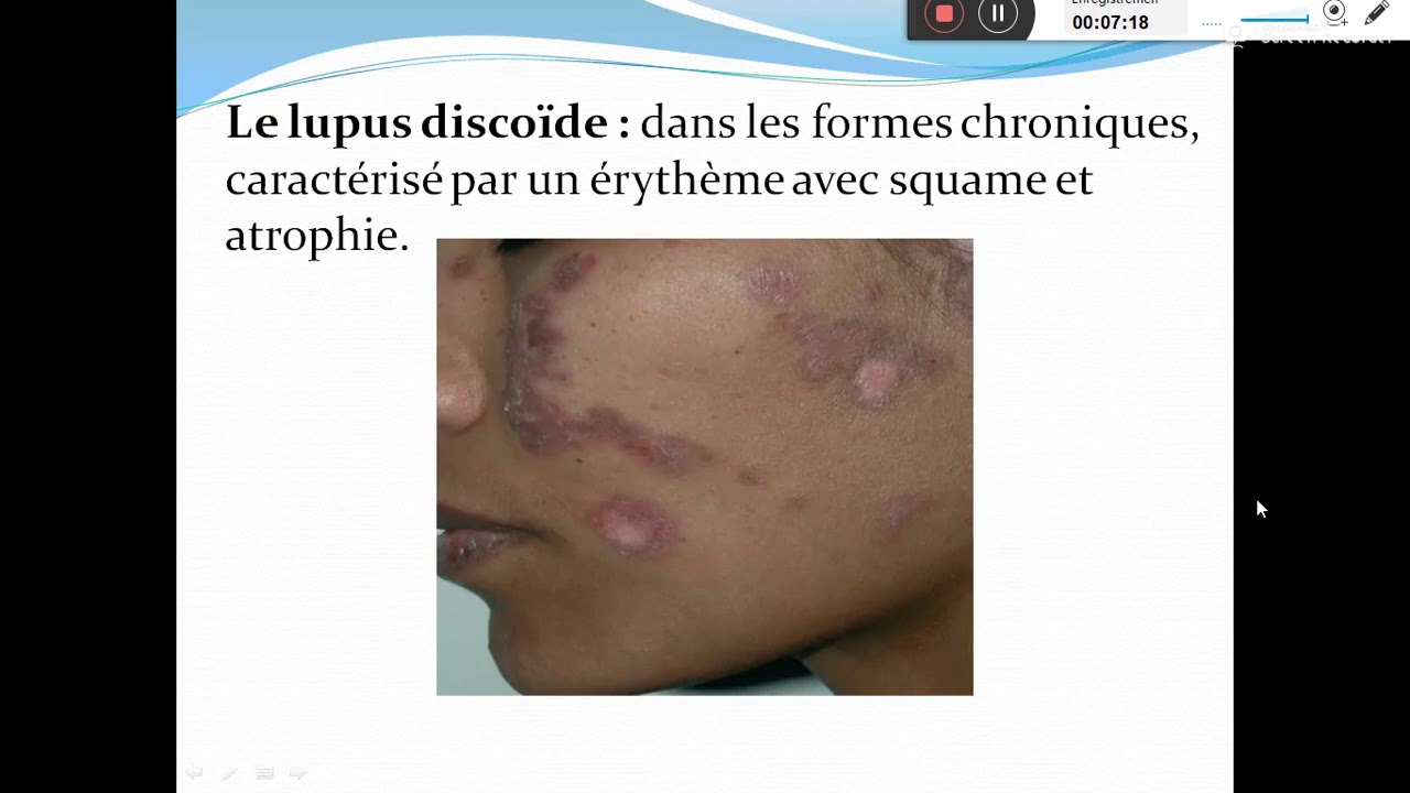 Les connectivites Dr BENAMMAR A
