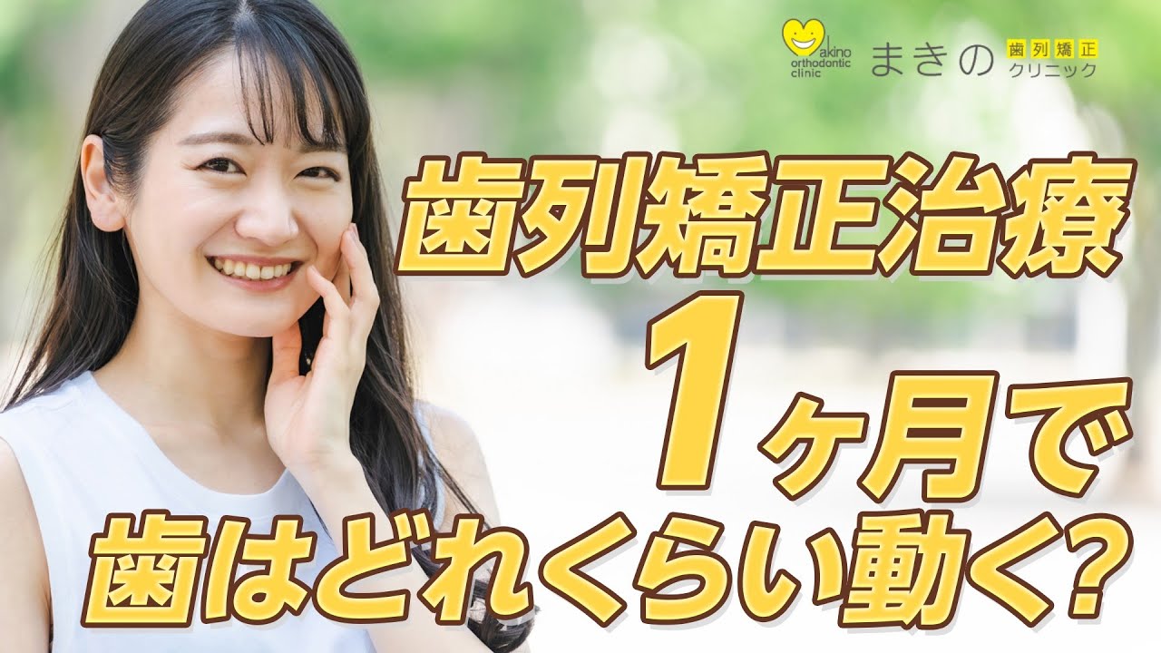 歯列矯正【1ヶ月】歯が動く量はどれくらい？【千葉県船橋近くの矯正歯科専門医】