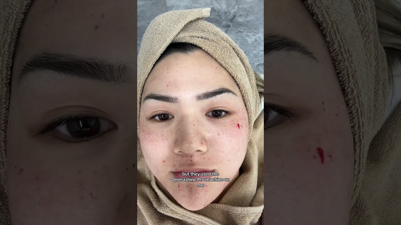 pojechałam do kliniki kosmetycznej w Japonii🧖🏻&zwj;♀️ część 2 #kr&oacute;tkie