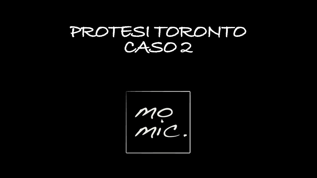 Protesi Implantare Toronto Provvisoria - Caso 2 (Laboratorio Momic)
