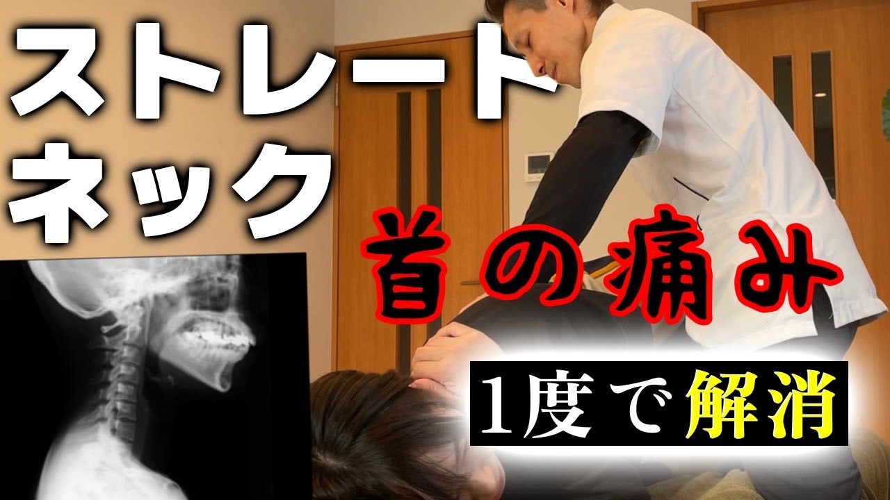前代未聞のストレートネック登場！首の痛みを抱え残業60時間をこなす女性