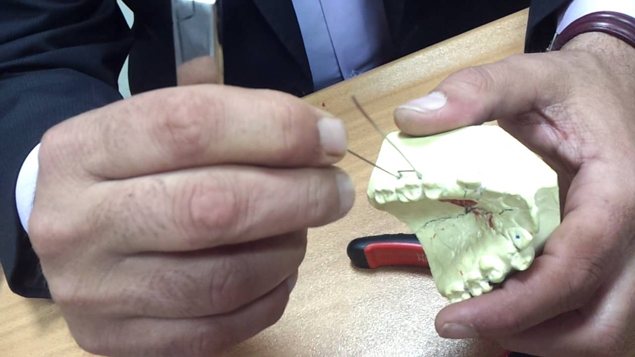 Orthodontics Lab.: Wire Bending1 : Adam's Clasp