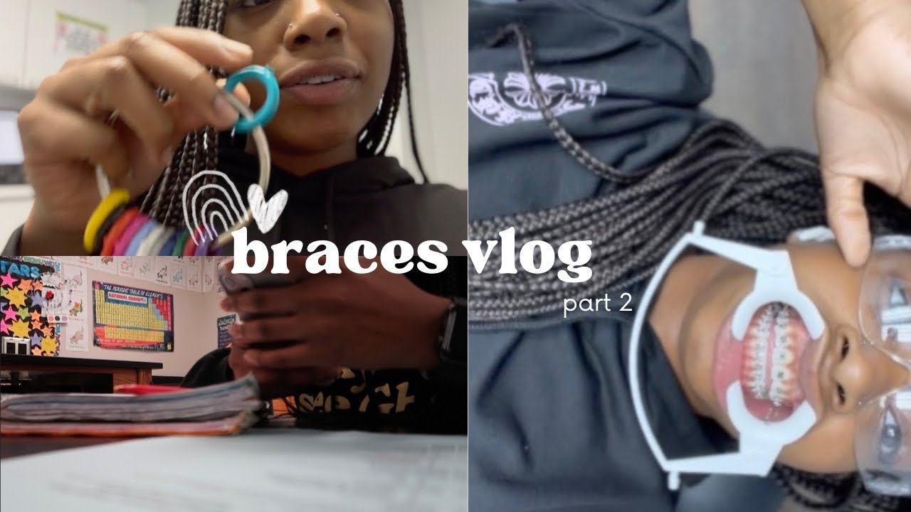 vlog | come get braces with me pt.2 (school, Costco run, bottom braces, updates etc.)