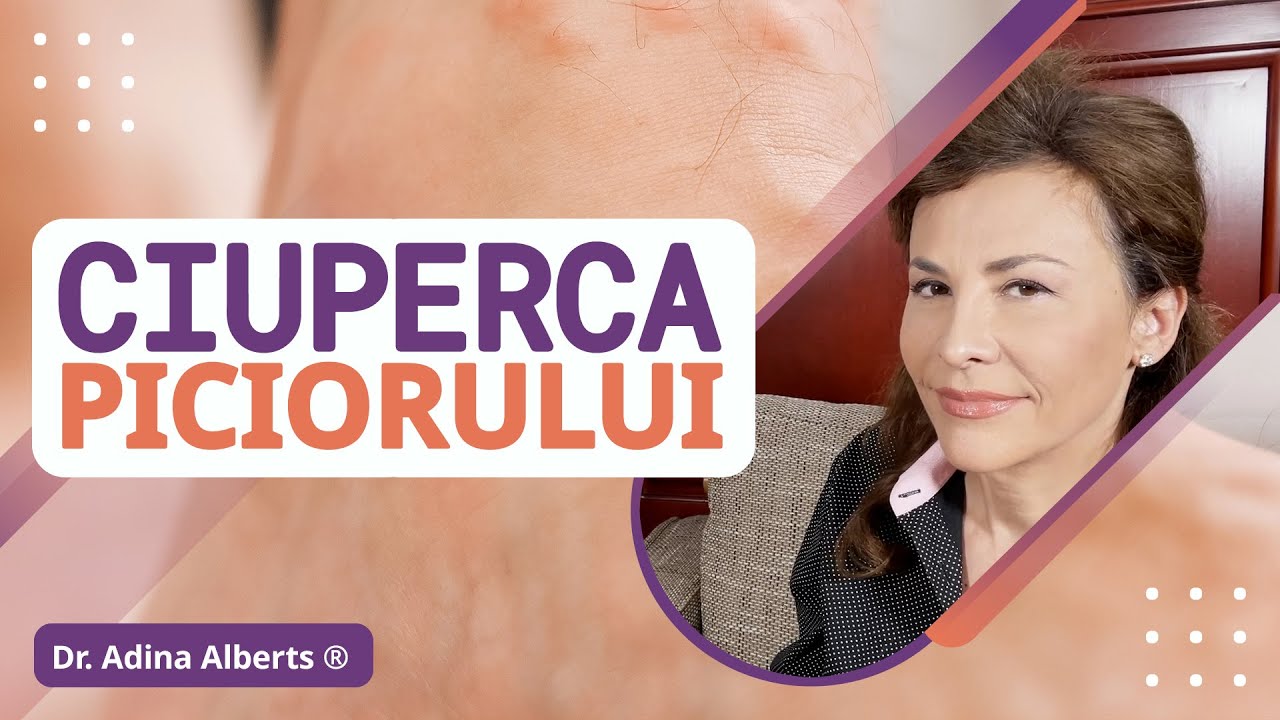 Ciuperca Piciorului - Ciuperca Unghiei - Sfaturi și recomandări simple - Prevenție și Tratament