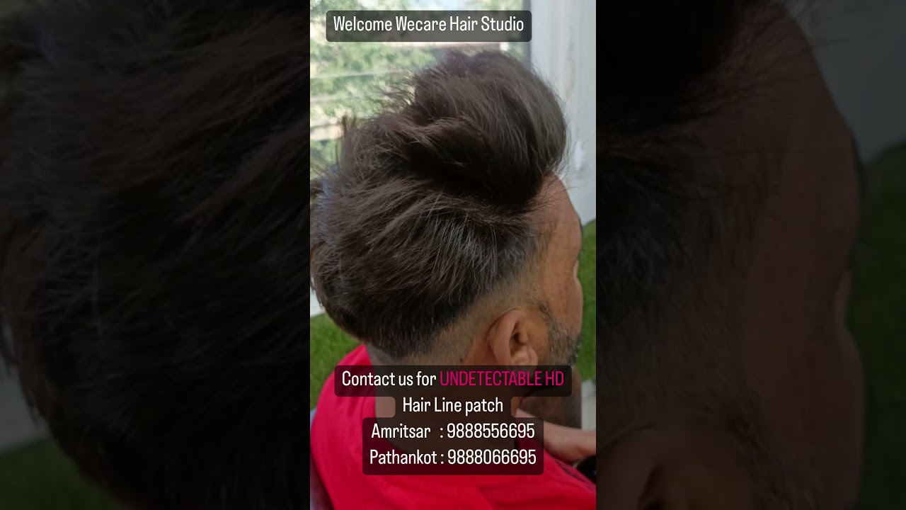 UNDETECTABLE HD HAIRLINE @WecareHairStudio