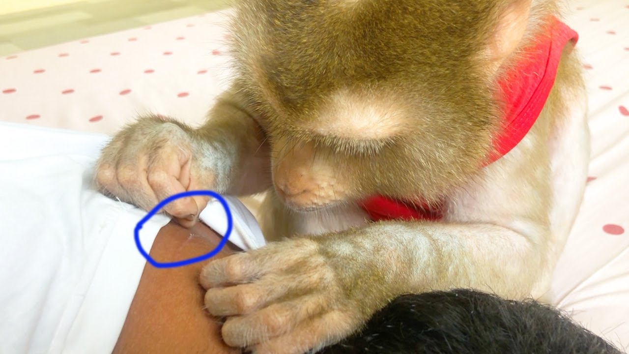 Dr. Jason Grooming Survey To Peel Off Died Cell On Neck