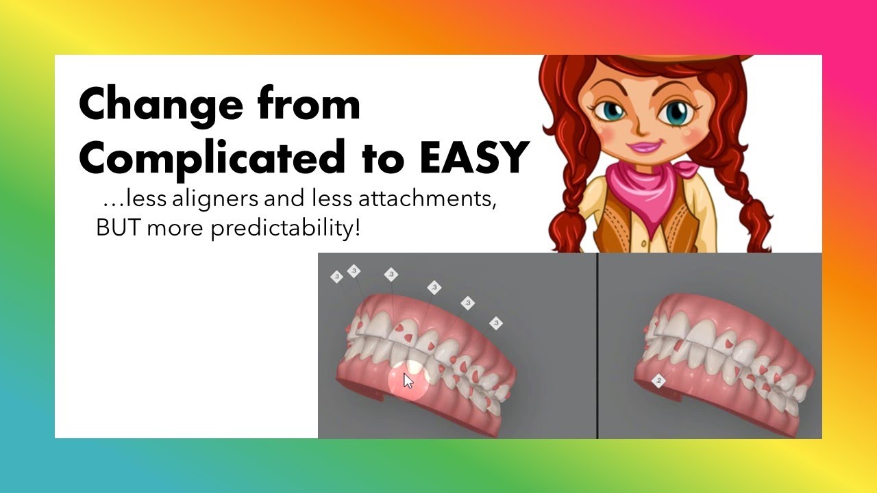 Invisalign ClinCheck - Complicated to EASY!