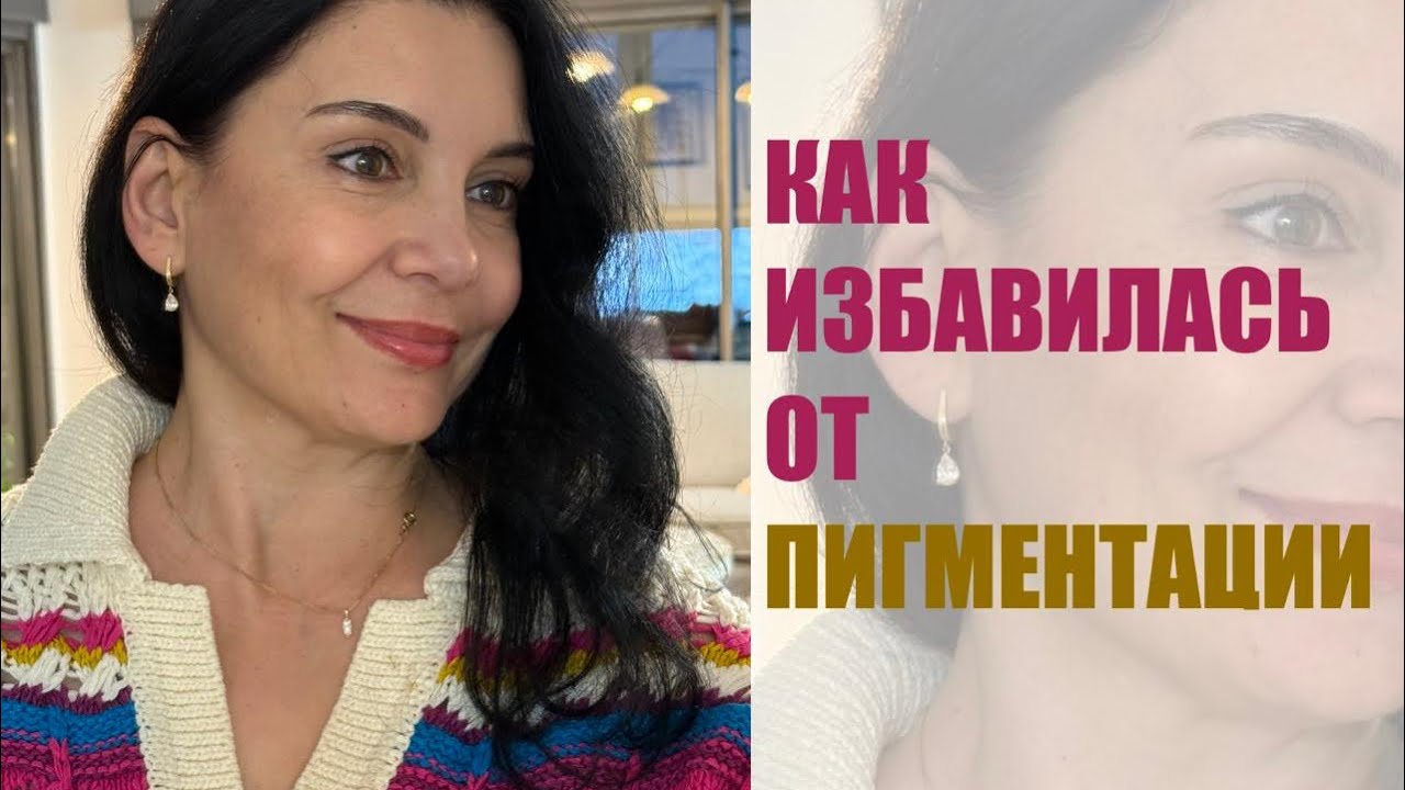 УХОД ЗА КОЖЕЙ ЛИЦА 50+.  ПИГМЕНТАЦИЯ И УКОЛЫ КРАСОТЫ.