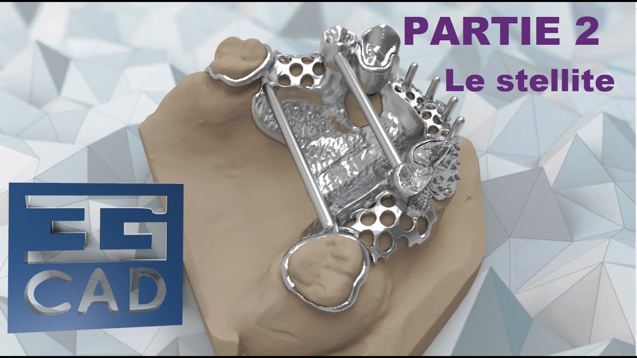 Tutoriel exocad: Couronnes primaire Part 2 - Réalisation du stellite