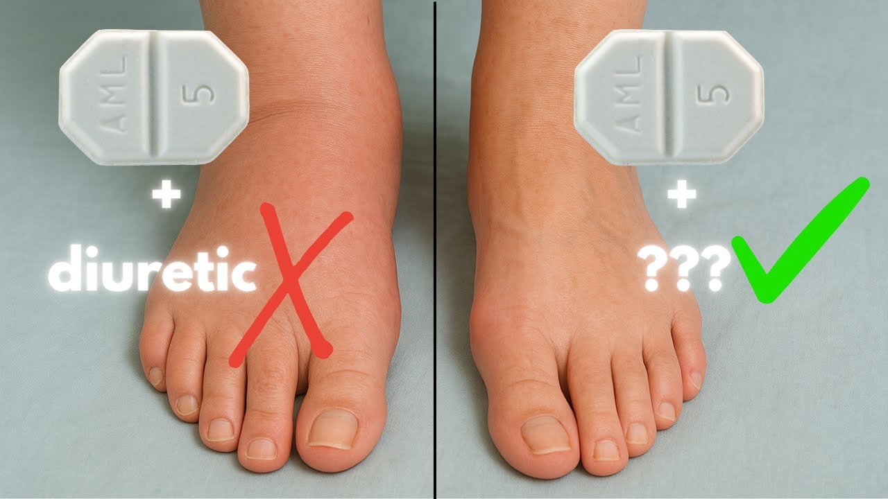 Amlodipine leg swelling and ankle edema EXPLAINED. and what you can do about it.