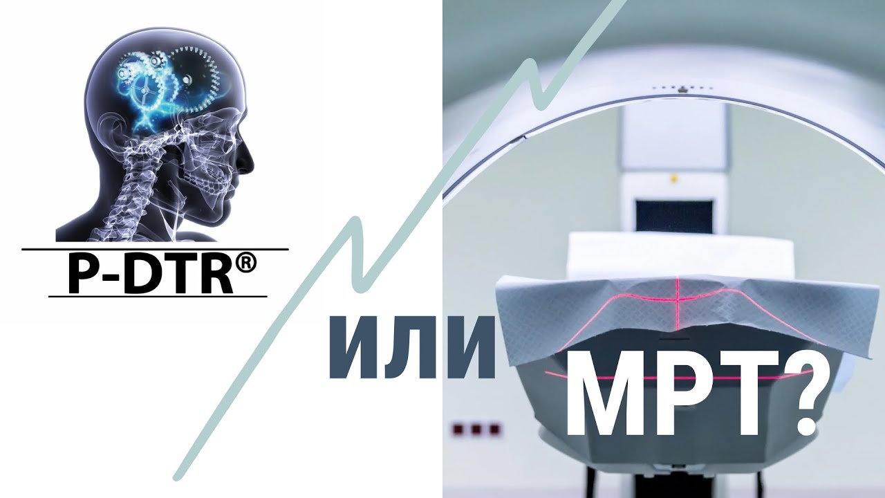 P-DTR или МРТ? | В чем преимущества методов диагностики? | мнение невролога и врача МРТ