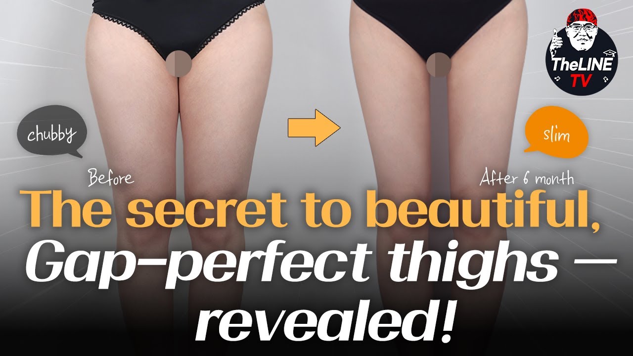 Korean Plastic Surgery Clinic Specializing in Liposuction – Thigh Liposuction #kbeauty #koreanclinic