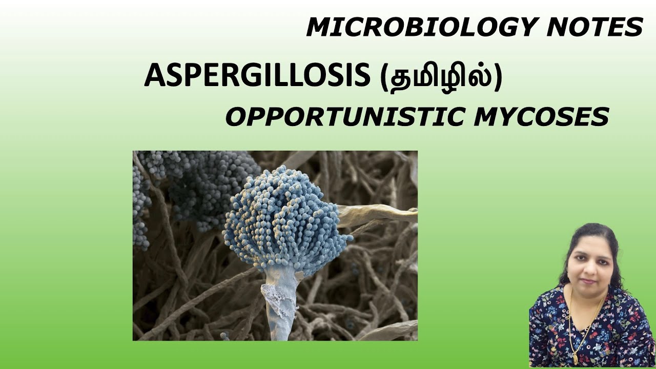 Aspergillosis / Opportunistic mycoses / Fungal infection / Dr. Blessy / Tamil / Microbiology notes