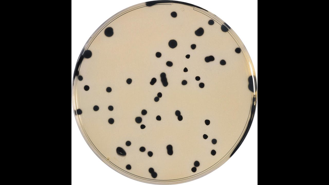Contagem de Clostridium perfringens