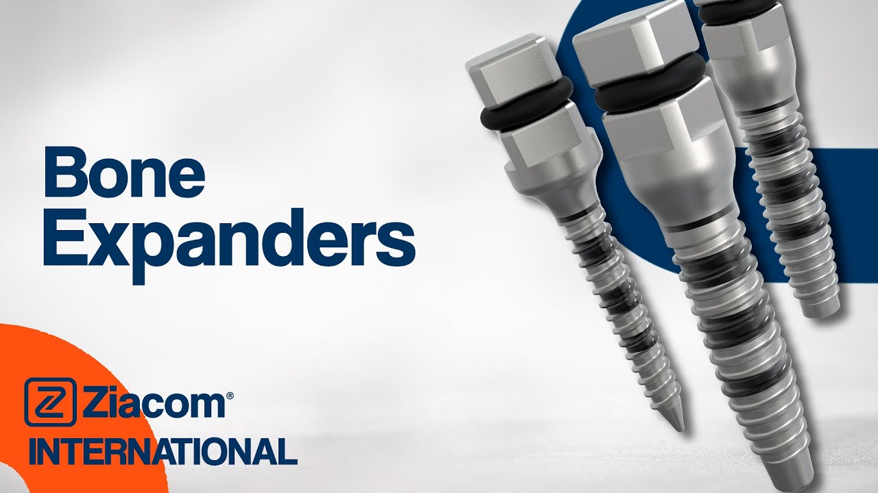Ziacom Bone Expanders Kit - The best ally in cases of deficient bone tissue.