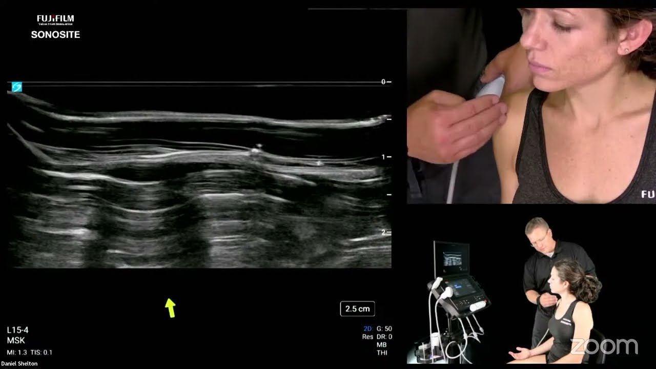 Diagnostic Shoulder Ultrasound: Part 1 - Anterior Shoulder