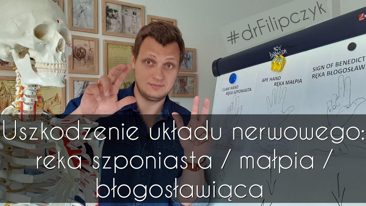 Ręka szponiasta, małpia i błogosławiąca - uszkodzenia układu nerwowego. #DrFilipczyk