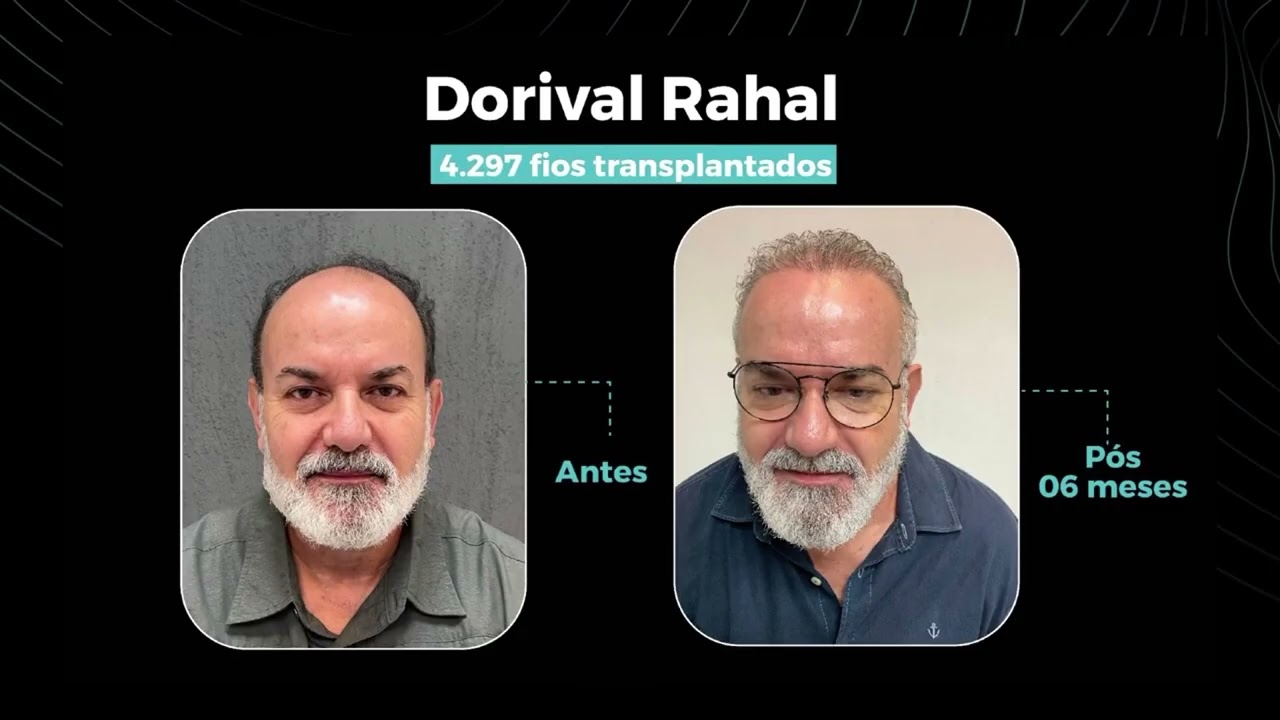 v&iacute;deo completo