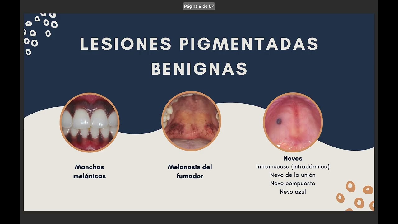 LESIONES EPITELIALES