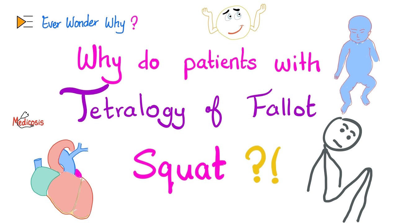 Tetralogy of Fallot (TOF) 😨 Patients Squat a lot&hellip;Ever Wonder Why? 🤷&zwj;♂️